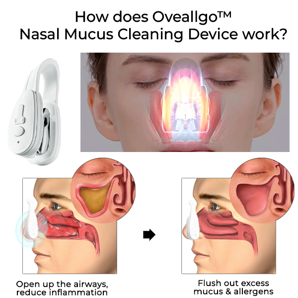 Dispositivo de limpieza de moco nasal Oveallgo™