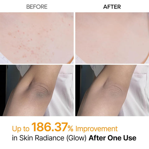 SPRAY EXFOLIANTE CORPORAL RADIANTE DIARIO